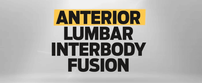 What is Anterior Lumbar Interbody Fusion (ALIF) 